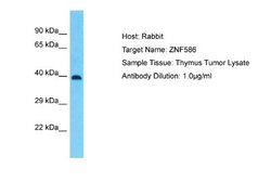 ZNF586 Rabbit anti-Human, Polyclonal, Novus Biologicals 0.1 mL | Buy Online | Novus Biologicals | Fisher Scientific